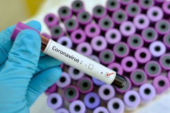 Коронавіруси: звідки вони беруться і чому такі смертоносні? – Українське  лікарське товариство у Львові